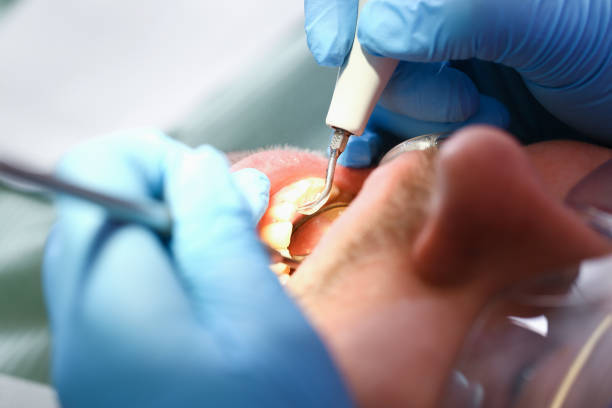 Best Weekend Emergency Dental Services in Fritch, TX